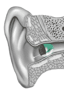 Invisible in the Canal Hearing Aid Styles